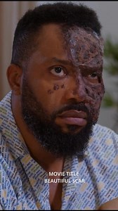 1M views · 10K reactions | Beautiful Scar #highlights #highlightseveryone #highlight | Mark Grandy | Facebook