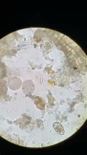 stool sample #microscope