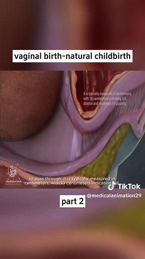 vaginal birth-natural childbirth 2