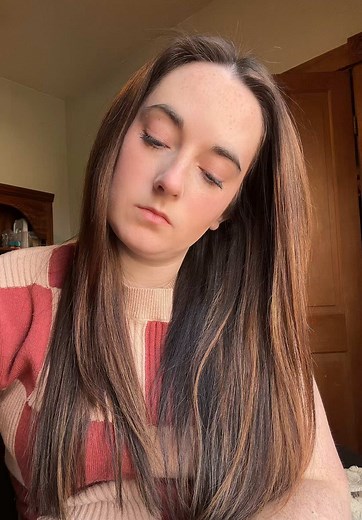 Important Food Allergy Facts and Statistics for 2024