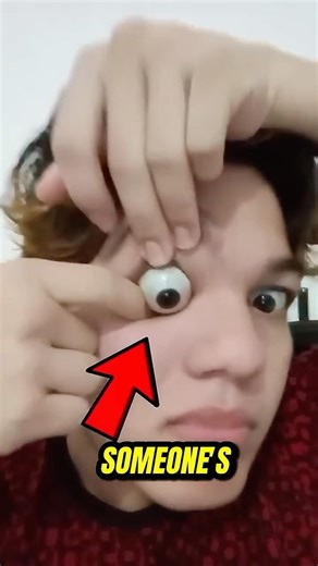 Why Your Eyeballs Are Pushing Out of Your Head #disease #eyes
