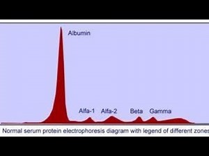 Normal Serum Protein Electrophoresis