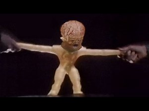 Stretch X-Ray By Kenner (Commercial, 1979)