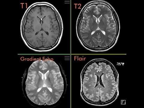 T1, T2, FLAIR, and Gradient Echo pulse sequences.