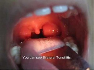Examination Of Tonsils