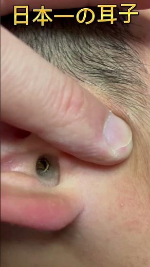 耳かき#衝撃#耳垢#耳くそ#耳子#気持ちいい瞬間#耳かきしたくなる#大きい耳くそ#大きすぎる耳垢#耳掃除#スッキリ#観覧注意#耳掃除のスペシャリスト