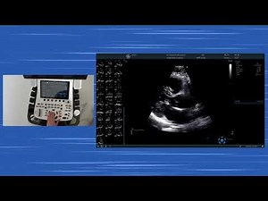 〖Echocardiography〗 Parasternal long axis hands-on - pulmonic veins & right ventricular inflow