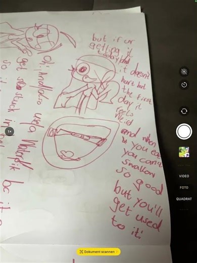 after my expander I’ll get my braces