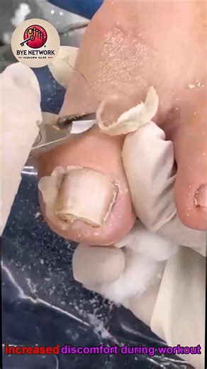 818. Avoid overtraining on a muscle-gain plan #ActiveLiving #RecoveryHabits #HealthyHabits | Bye