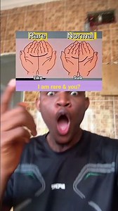 Are you Rare or Normal??