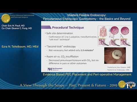 Evidence Based PEG Placement and Peri-operative Management