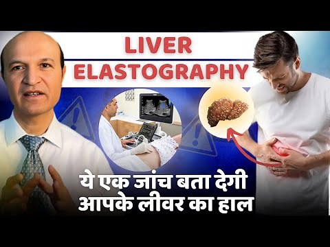 Unlocking Liver Health: How Shear Wave Elastography (fibroscan) Reveals Hidden Secrets