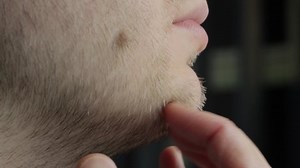 A young white man with red stubble and a double chin with a mole on his cheek smiles for the camera. Guy scratches his beard. Aesthetic defect, fatty deposits on the chin