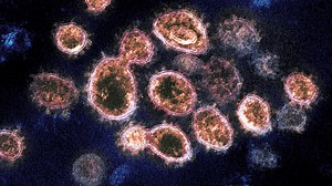 79 fully vaccinated Mass. residents have died from breakthrough COVID-19 infections, data shows