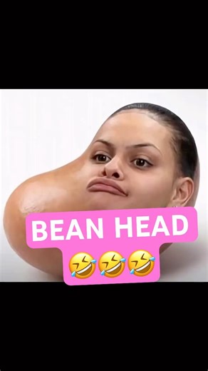 Bean Head Meme 🫘 #funny