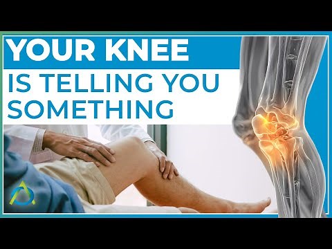 Arthritis in the Knee: Signs, Stages, and What You Can Do | Orthobiologics Associates