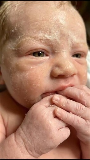 Painful Yet Beautiful Journey of Giving Birth to Twins👶💞 the Pure Magic #shorts #viral #motherhood