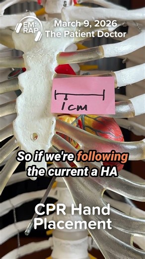 CPR Hand Placement