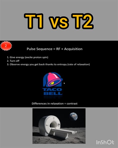 72K views · 560 reactions | CT Scan and MRI study on Reels | Facebook