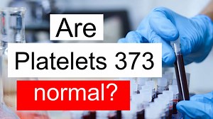 Treatment and symptoms of Platelet count 373 thou/uL | Diet for normal Platelet count level 373 thou/uL