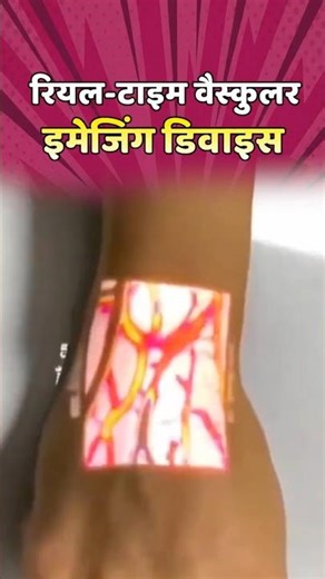 real-time blood vessels dikhane wali machine # #comedy #funny #dailylifecomedy #relatable #trending