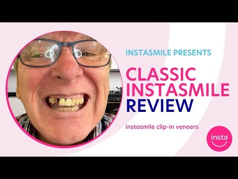 Instasmile product review and experience! Cover missing teeth with instasmile classic veneers