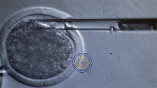 Identical twins and cloning