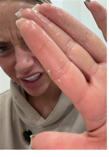 Understanding Dead Skin Shedding on Your Face