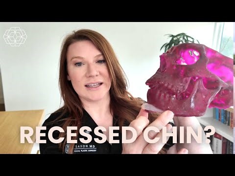 Correcting a Recessed Chin: Sliding Genioplasty vs Chin Implant