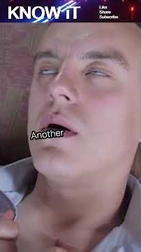 🧬🩸 10 Intriguing Facts About Neutropenia ⚠️🛡️