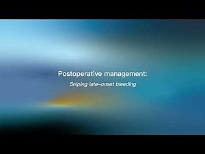 Key strategies for hemostasis in endoscopic submucosal dissection (ESD)