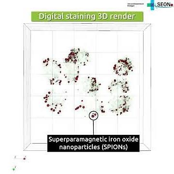 Superparamagnetic iron oxide nanoparticles (SPIONs) and Nanolive imaging: the perfect combination?
