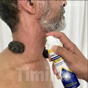 “Too scared to cut it off, and too tired of hiding it.” If you’ve had a mole or skin tag for years, you already know the frustration: • Dermatologists charge $300–$400 for removal • Cutting it off sounds painful • And seeing it in the mirror every day makes you feel worse That’s exactly why Timilk® ChillErase Clinical Spray was created — a simple, at-home alternative that actually works. “I had a skin tag on my neck for 5 years. I was terrified to get it cut off. I started using Timilk® ChillEra