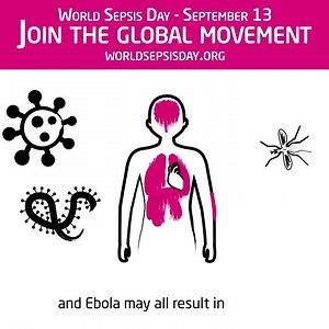 What can cause Sepsis? Watch the video to find out more... | Hull University Teaching Hospitals NHS Trust | Facebook