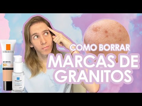 COMO BORRAR MARCAS DE ACNE de manera rápida y segura