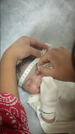 What No One Tells You About Measuring Head Size at Birth! #shorts