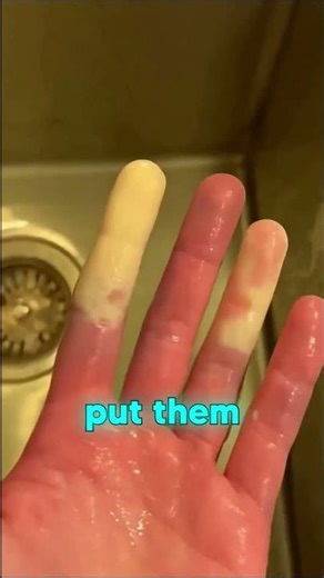 This Girl Can Control The Color Of Her Fingers!! 😱#shorts