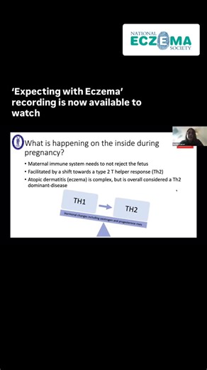 Expecting with eczema? In this preview from our latest Webinar with St John’s Derm Academy, we dive into how pregnancy can affect eczema - from flare-ups and common triggers and ways to manage them. The full session also covers: - Eczema safe treatments during conception and pregnancy - What to expect during each trimester - A live panel QnA with expert dermatologists 📺 Watch the full webinar now on our YouTube channel or website - link in bio. | Eczema UK