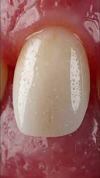 Seu Dente Caindo é Alerta! ⚠️ O Verdadeiro Significado de Sonhar com Dentes