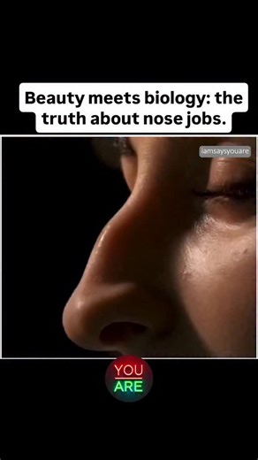 Beauty meets biology: the truth about nose jobs. For some, it’s cosmetic. For others, it’s survival. Rhinoplasty isn’t just reshaping a nose—it’s reshaping confidence, breath, and balance. Behind every “before and after” is a story of someone who wanted to feel normal again, to breathe clearly, to look in the mirror and finally recognize themselves. More Than Aesthetics Rhinoplasty isn’t vanity—it’s restoration. It can fix injuries and lifelong breathing issues. (Psalm 139:14 – “I praise you bec