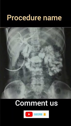 procedure name #viral #shorts #youtubeshorts ‪@AzhaR-live-5.2k-view‬