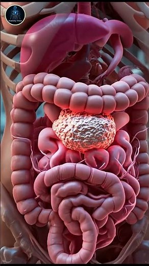Stool Stuck in the Colon: What Really Happens Inside
