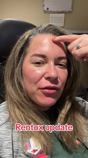 #diybeauty #toxin #botox #botoxcheck #diyskincare #rentox #at #homebotox #athomebotox #botoxupdate