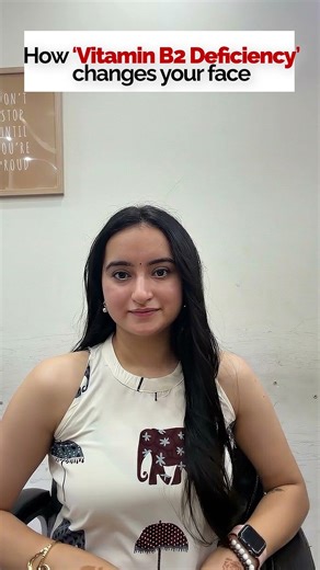 5 Vitamin Deficiencies That Show on Your Skin | Signs of Nutrient Deficiency You Shouldn’t Ignore