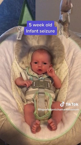 5 week old infant seizure. Body jerks, eyes closing and face tightening, loses awareness between each cluster, then can see his eyes brighten up when he come through it, tongue and mouth movements, uncontrolled vocalization at end. #infantseizures #infantseizureawareness #body #seizure #epilepsy #clusterseizures #awareness #unconscious #loseconsciousness #infant #baby #babytok #babylove #babyboy #viral #viralvideos #spreadawareness