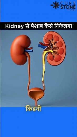 Urine formation in kidney animation | How urine forms in kidney#Stones