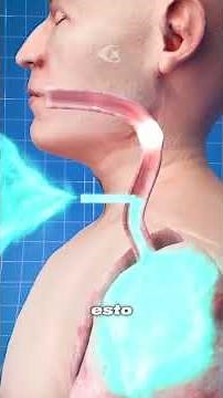 How is a tracheostomy performed? #biology #medicine