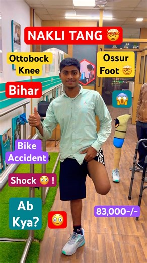 🤯😱Above Knee Prosthetic Leg | Ossur Microprocessor Knee | Ottobock 3R80 | #ossur #ottobock #3r80