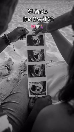 Yared + Bethlehem on Instagram: "At 21 weeks, your baby is about the size of a banana, moving a lot, and starting to hear your voice 💕 #babyambaw #pregnancy #pregnant #may2026 #21weeks"