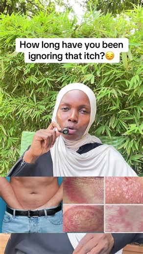 Understanding the Signs of Skin Infections